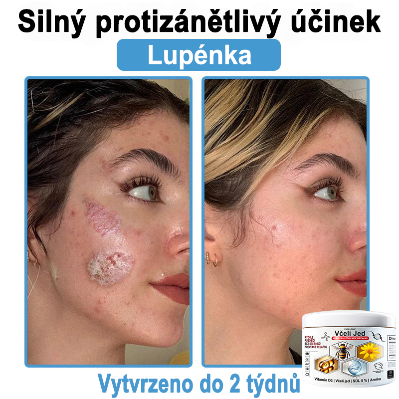 🔥 Pouze dnes sleva 70 % 🎁Purelora®  Vyrobeno z kvalitního materiálu 🏆 vyrobeného z kvalitního materiálu (👨‍⚕ÚVODNÍ STRANA)⚡（副本）