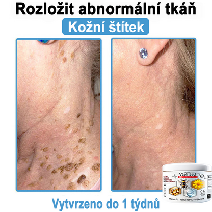 🔥 Pouze dnes sleva 70 % 🎁Purelora®  Vyrobeno z kvalitního materiálu 🏆 vyrobeného z kvalitního materiálu (👨‍⚕ÚVODNÍ STRANA)⚡（副本）