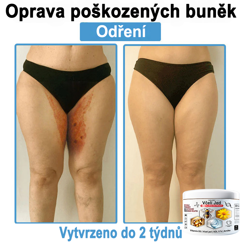 🔥 Pouze dnes sleva 70 % 🎁Purelora®  Vyrobeno z kvalitního materiálu 🏆 vyrobeného z kvalitního materiálu (👨‍⚕ÚVODNÍ STRANA)⚡（副本）