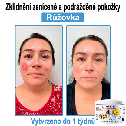 🔥 Pouze dnes sleva 70 % 🎁Purelora®  Vyrobeno z kvalitního materiálu 🏆 vyrobeného z kvalitního materiálu (👨‍⚕ÚVODNÍ STRANA)⚡（副本）