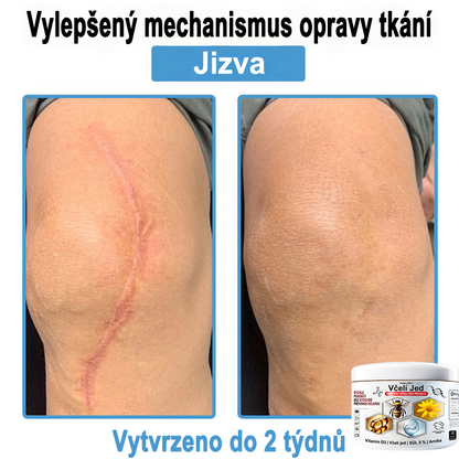 🔥 Pouze dnes sleva 70 % 🎁Purelora®  Vyrobeno z kvalitního materiálu 🏆 vyrobeného z kvalitního materiálu (👨‍⚕ÚVODNÍ STRANA)⚡（副本）