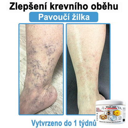 🔥 Pouze dnes sleva 70 % 🎁Purelora®  Vyrobeno z kvalitního materiálu 🏆 vyrobeného z kvalitního materiálu (👨‍⚕ÚVODNÍ STRANA)⚡（副本）