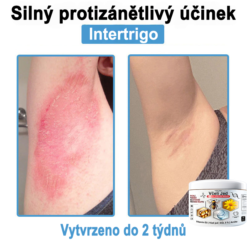 🔥 Pouze dnes sleva 70 % 🎁Purelora®  Vyrobeno z kvalitního materiálu 🏆 vyrobeného z kvalitního materiálu (👨‍⚕ÚVODNÍ STRANA)⚡（副本）