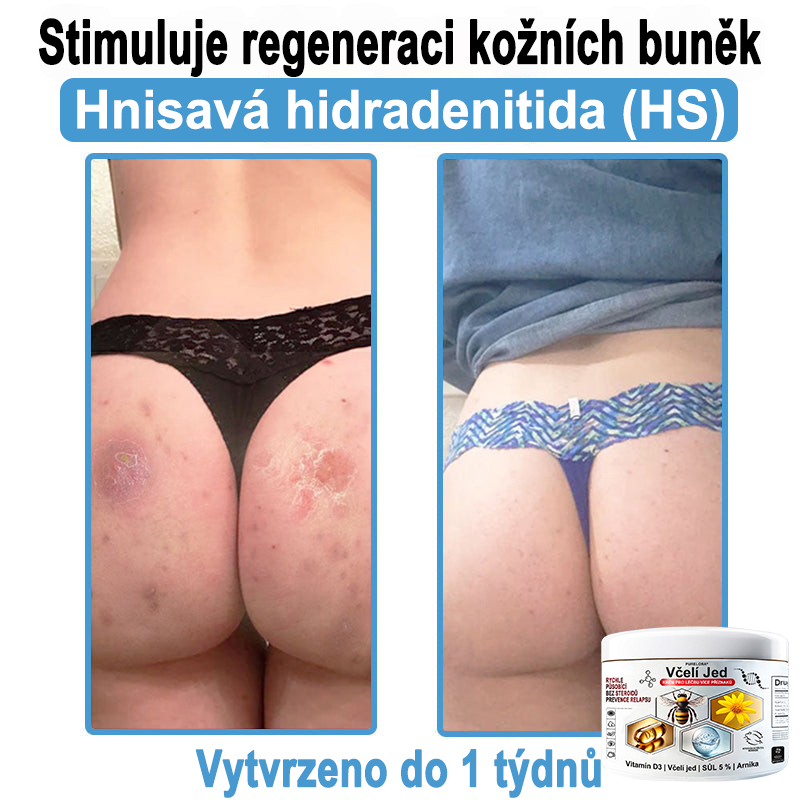 🔥 Pouze dnes sleva 70 % 🎁Purelora®  Vyrobeno z kvalitního materiálu 🏆 vyrobeného z kvalitního materiálu (👨‍⚕ÚVODNÍ STRANA)⚡（副本）
