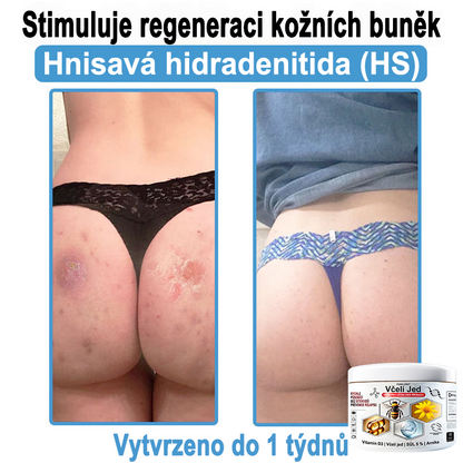 🔥 Pouze dnes sleva 70 % 🎁Purelora®  Vyrobeno z kvalitního materiálu 🏆 vyrobeného z kvalitního materiálu (👨‍⚕ÚVODNÍ STRANA)⚡（副本）
