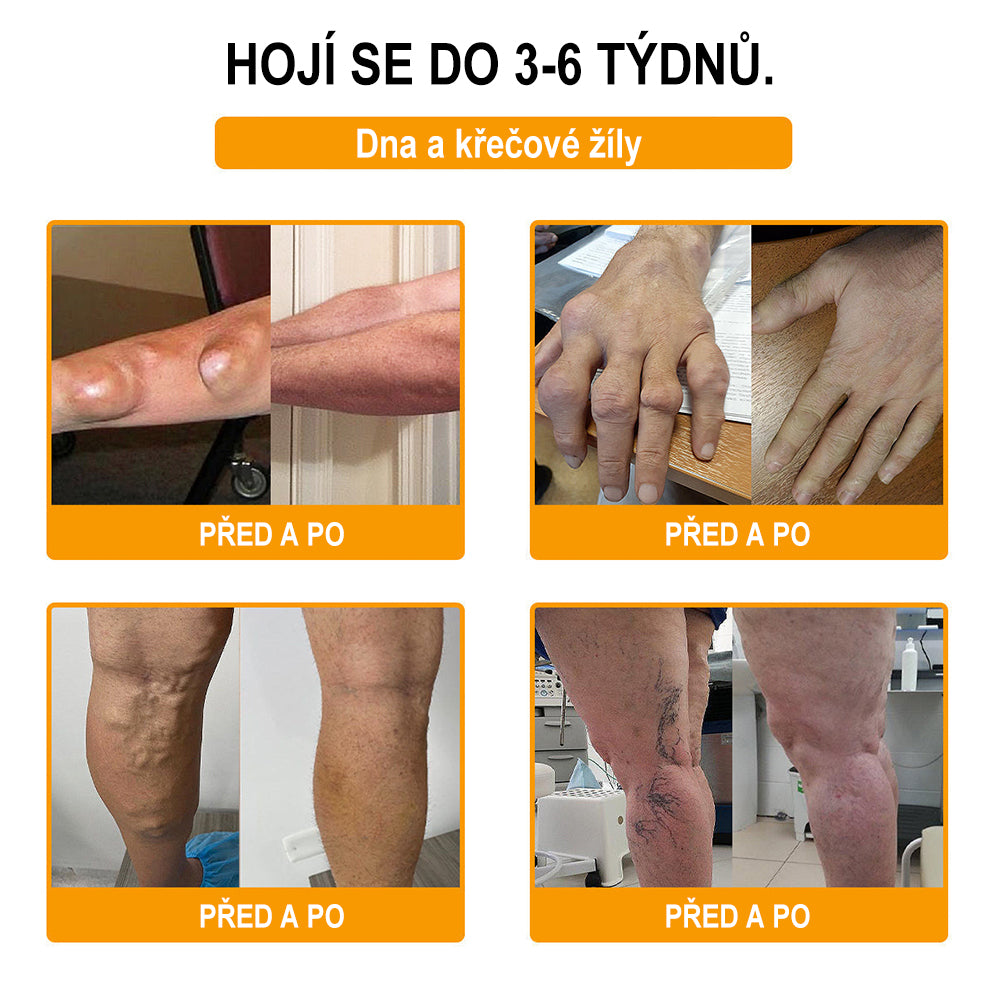 Krém na zmírnění bolesti a zpevnění kostí Purelora® s botulotoxinem a včelím jedem 🐝🌿 (Speciálně pro seniory a doporučen ortopedickými specialisty) 🔥🔥