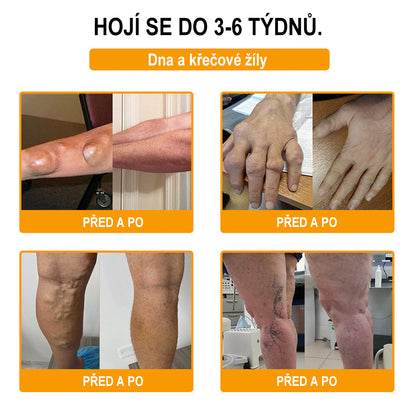 Krém na zmírnění bolesti a zpevnění kostí Purelora® s botulotoxinem a včelím jedem 🐝🌿 (Speciálně pro seniory a doporučen ortopedickými specialisty) 🔥🔥