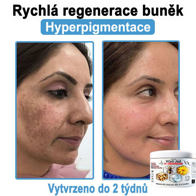 🔥 Pouze dnes sleva 70 % 🎁Purelora®  Vyrobeno z kvalitního materiálu 🏆 vyrobeného z kvalitního materiálu (👨‍⚕ÚVODNÍ STRANA)⚡（副本）