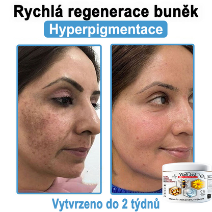 🔥 Pouze dnes sleva 70 % 🎁Purelora®  Vyrobeno z kvalitního materiálu 🏆 vyrobeného z kvalitního materiálu (👨‍⚕ÚVODNÍ STRANA)⚡（副本）
