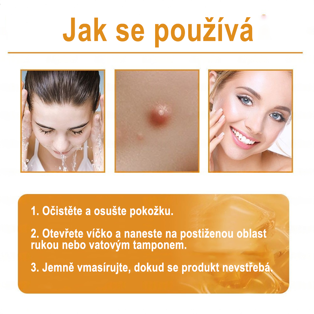 🇨🇿 ZödVita® Krém na obnovu pleti s včelím jedem☄️ Přírodní krém proti stárnutí, zpevňuje pleť, redukuje vrásky – 50 ml