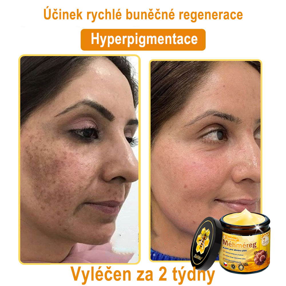 🇨🇿 ZödVita® Krém na obnovu pleti s včelím jedem☄️ Přírodní krém proti stárnutí, zpevňuje pleť, redukuje vrásky – 50 ml