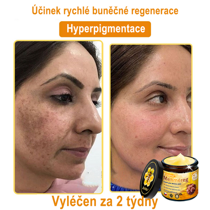 🇨🇿 ZödVita® Krém na obnovu pleti s včelím jedem☄️ Přírodní krém proti stárnutí, zpevňuje pleť, redukuje vrásky – 50 ml