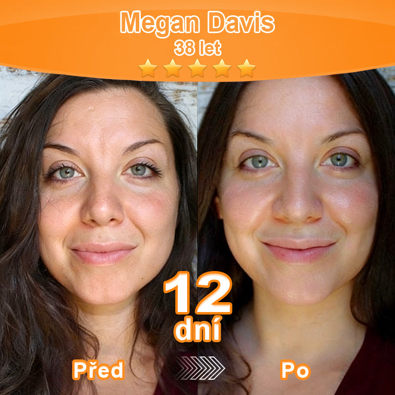 🇨🇿Purelora® Őssejt Kivonatú EGF és Rézpeptid Revitalizáló💝 Esszencia Krém (mélyen aktiválja a bőr belső regenerációját, feszesebbé és simábbá varázsolja a bőrt)