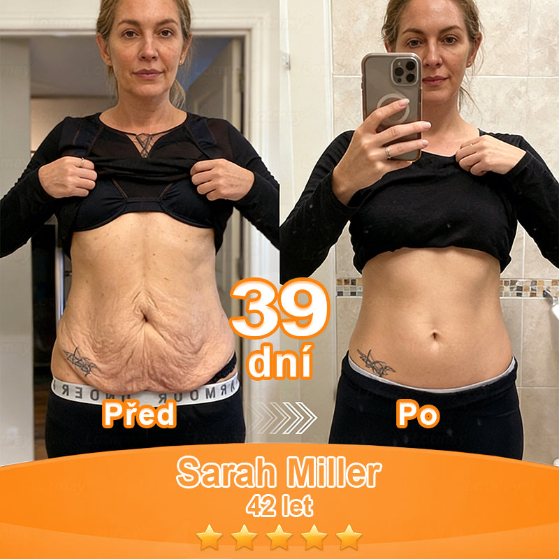 🇨🇿Purelora® Őssejt Kivonatú EGF és Rézpeptid Revitalizáló💝 Esszencia Krém (mélyen aktiválja a bőr belső regenerációját, feszesebbé és simábbá varázsolja a bőrt)