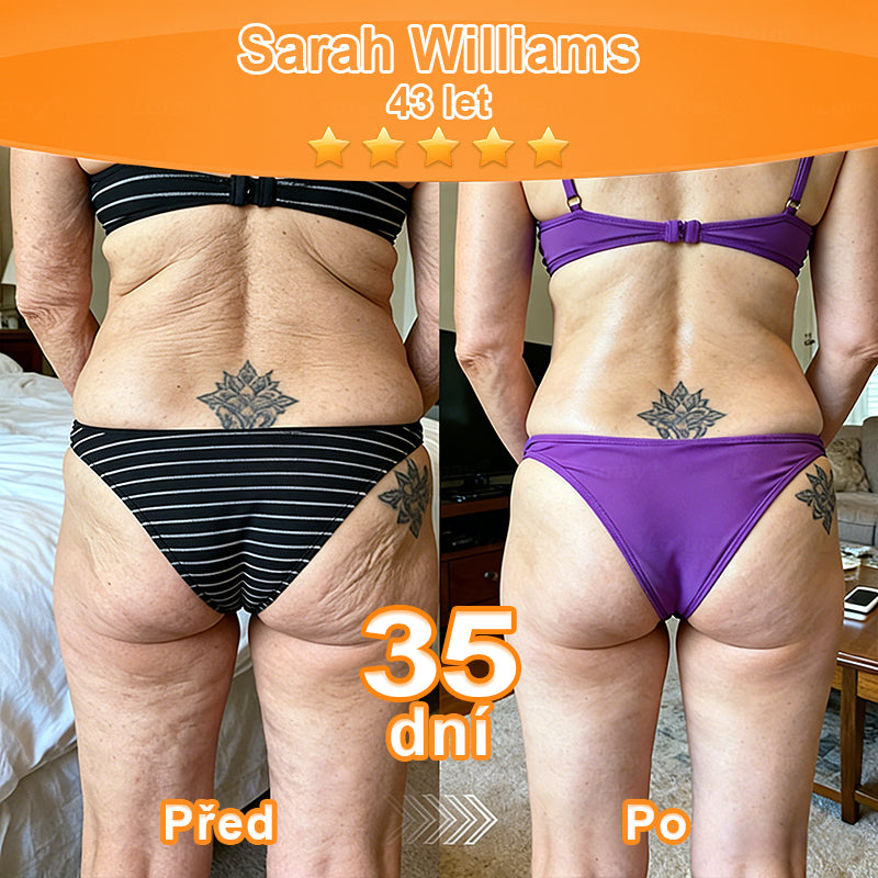 🇨🇿Purelora® Őssejt Kivonatú EGF és Rézpeptid Revitalizáló💝 Esszencia Krém (mélyen aktiválja a bőr belső regenerációját, feszesebbé és simábbá varázsolja a bőrt)