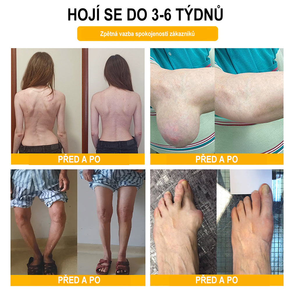 Krém na zmírnění bolesti a zpevnění kostí Purelora® s botulotoxinem a včelím jedem 🐝🌿 (Speciálně pro seniory a doporučen ortopedickými specialisty) 🔥🔥