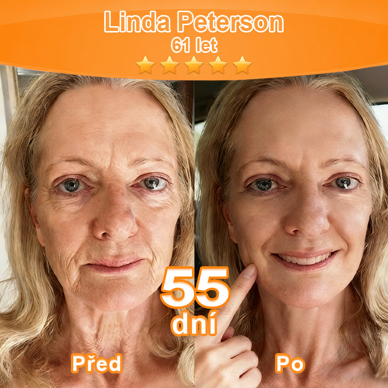 🇨🇿Purelora® Őssejt Kivonatú EGF és Rézpeptid Revitalizáló💝 Esszencia Krém (mélyen aktiválja a bőr belső regenerációját, feszesebbé és simábbá varázsolja a bőrt)