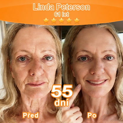 🇨🇿Purelora® Őssejt Kivonatú EGF és Rézpeptid Revitalizáló💝 Esszencia Krém (mélyen aktiválja a bőr belső regenerációját, feszesebbé és simábbá varázsolja a bőrt)