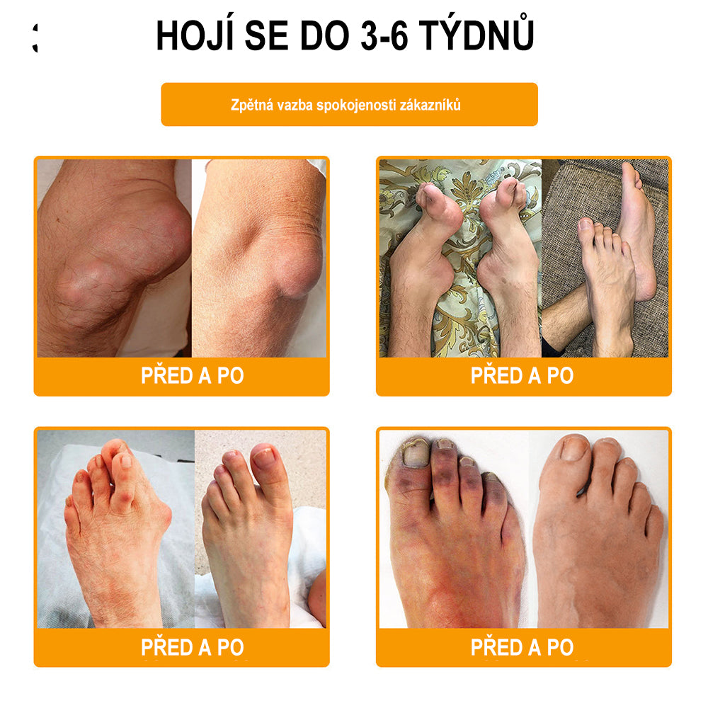 Krém na zmírnění bolesti a zpevnění kostí Purelora® s botulotoxinem a včelím jedem 🐝🌿 (Speciálně pro seniory a doporučen ortopedickými specialisty) 🔥🔥