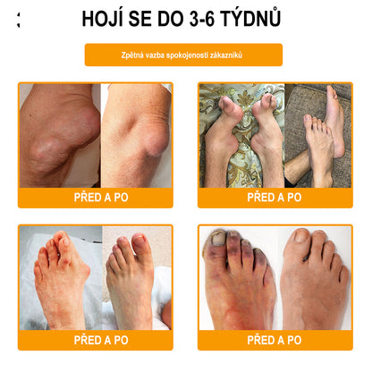 Krém na zmírnění bolesti a zpevnění kostí Purelora® s botulotoxinem a včelím jedem 🐝🌿 (Speciálně pro seniory a doporučen ortopedickými specialisty) 🔥🔥