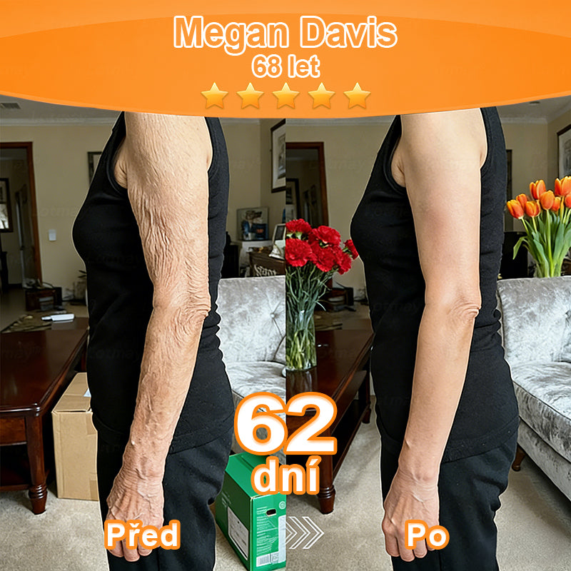 🇨🇿Purelora® Őssejt Kivonatú EGF és Rézpeptid Revitalizáló💝 Esszencia Krém (mélyen aktiválja a bőr belső regenerációját, feszesebbé és simábbá varázsolja a bőrt)