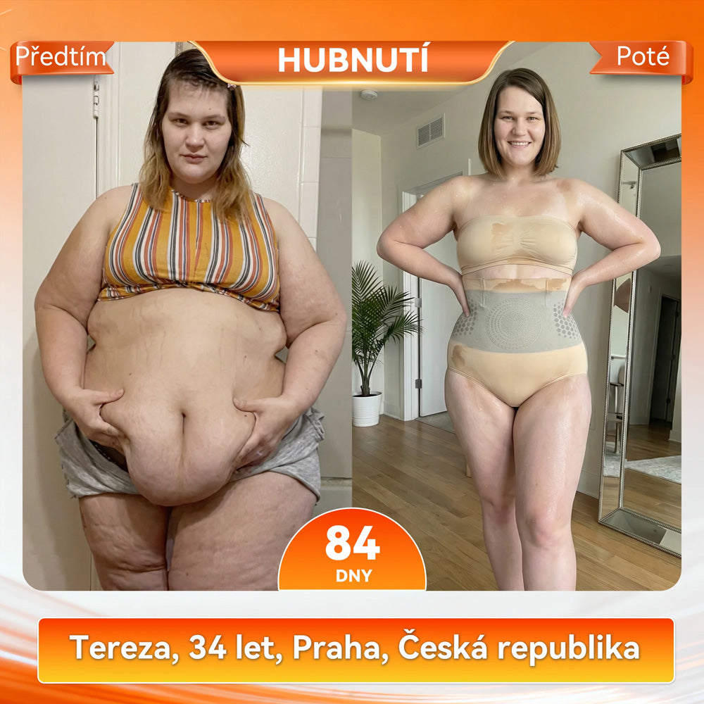 🎉Sfrcord® 4v1 Termogenní Tvarující Šortky s Moringou a Berberin 🎀– 😻 Kompresní Kraťasy pro Tvarování Postavy, Podporu Metabolismu & Denní Nošení (30 min rutina) 🌸 Časově omezená sleva až 70 %🔥
